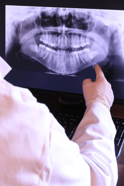 Best Emergency Treatment for Dental Infections or Abscesses in Ohatchee, AL