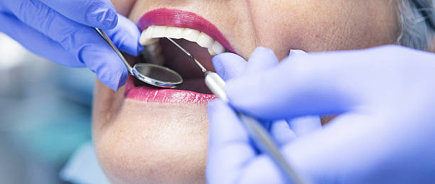 Best Emergency Treatment for Dental Infections or Abscesses in Ohatchee, AL